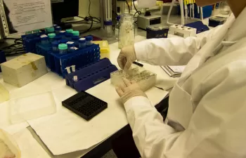 El IIAMA estudia la prevención y reducción de infección por Helicobacter pylori