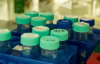 Las futuras leyes sobre reutilización de agua deberían incluir una evaluación del riesgo microbiológico