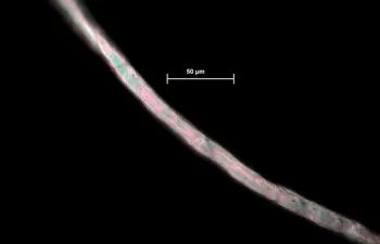 Microfibras textiles en los fondos marinos de los mares del sur de Europa